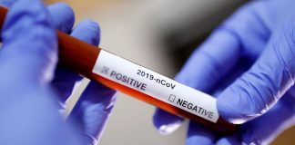 Itaocara investiga caso suspeito de coronavírus