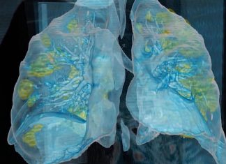 Mais três pacientes morrem por Covid-19 em Itaperuna; agora são 123 óbitos pela doença no município