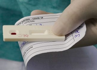 Rio registra 19.836 mortes por Covid-19