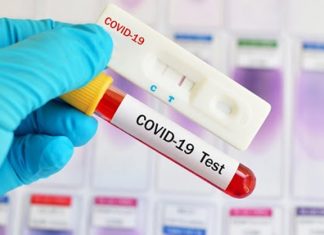 Brasil confirma 14.318 casos de covid-19 nas últimas 24 horas