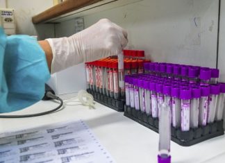 Itaperuna registra mais cinco mortes por covid-19; agora são 102 óbitos pela doença no município