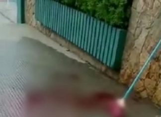 Homem é atacado por cachorro da raça Pit Bull em Bom Jesus do Itabapoana